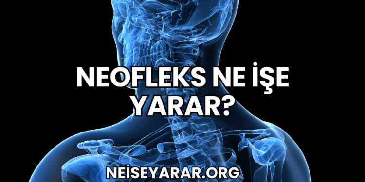 Neofleks Ne İşe Yarar?