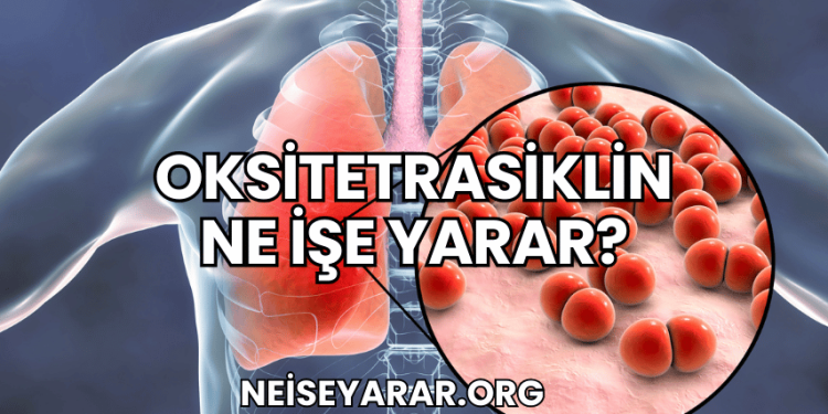 Oksitetrasiklin Ne İşe Yarar?