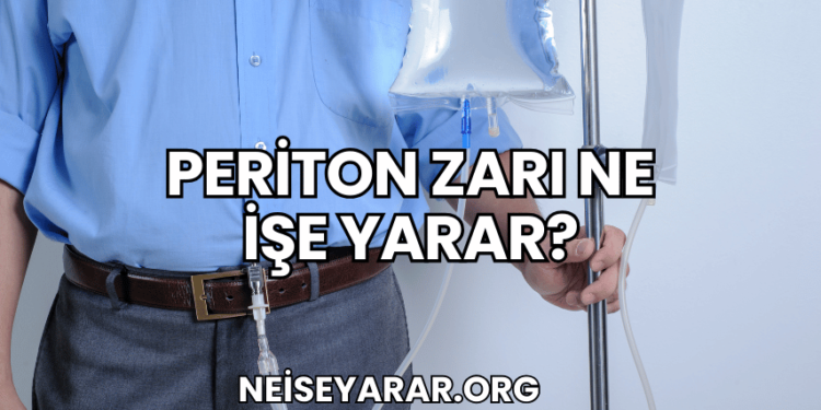 Periton Zarı Ne İşe Yarar?