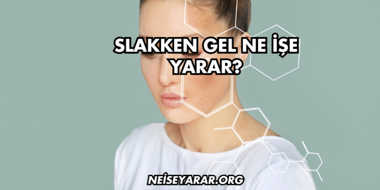 Slakken Gel Ne İşe Yarar?