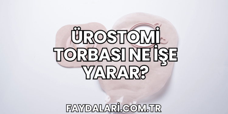 Ürostomi Torbası Ne İşe Yarar?