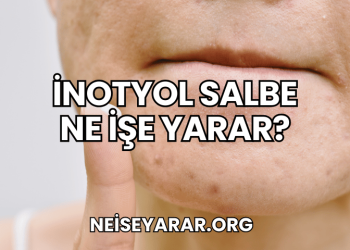 İnotyol Salbe Ne İşe Yarar?