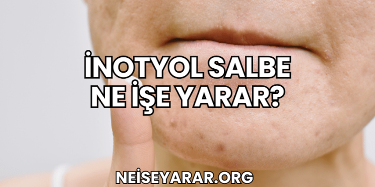İnotyol Salbe Ne İşe Yarar?