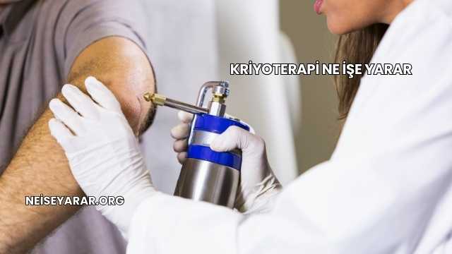 Kriyoterapi Ne İşe Yarar