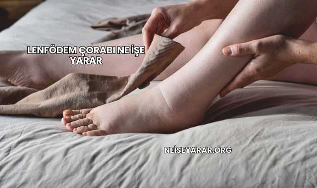 Lenfödem Çorabı Ne İşe Yarar
