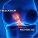 Ligament Ne İşe Yarar?