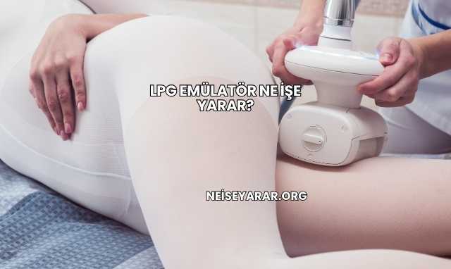 Lpg Emülatör Ne İşe Yarar?