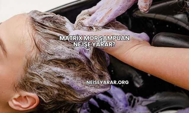 Matrix Mor Şampuan Ne İşe Yarar?