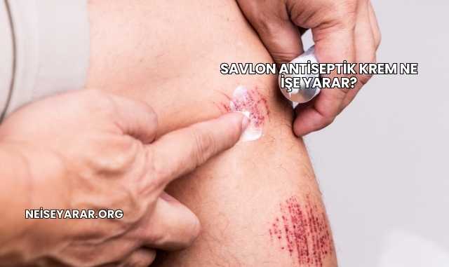 Savlon Antiseptik Krem Ne İşe Yarar?