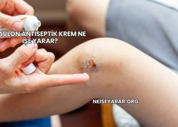 Savlon Antiseptik Krem Ne İşe Yarar?
