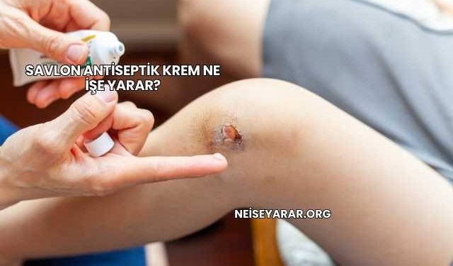Savlon Antiseptik Krem Ne İşe Yarar?