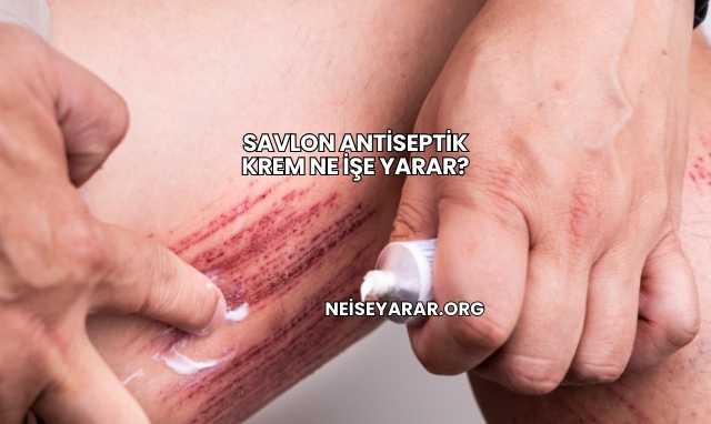 Savlon Antiseptik Krem Ne İşe Yarar?