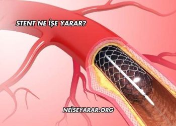 Stent Ne İşe Yarar?