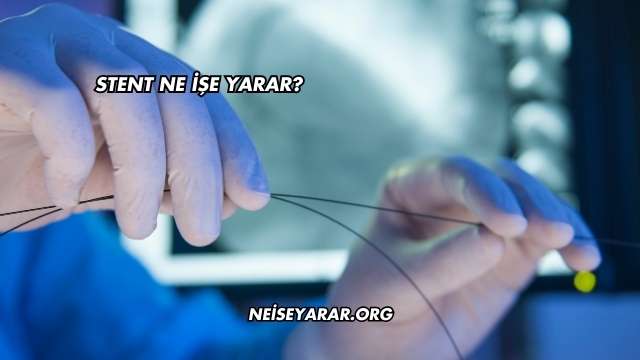 Stent Ne İşe Yarar?