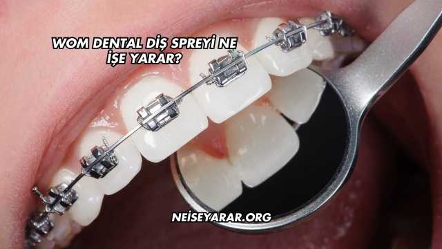 Wom Dental Diş Spreyi Ne İşe Yarar?