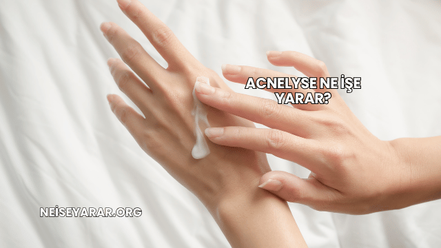 Acnelyse Ne İşe Yarar?
