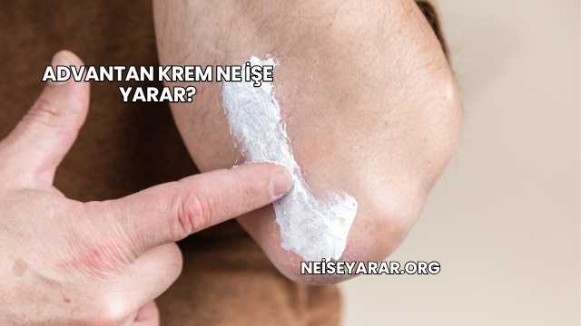 Advantan Krem Ne İşe Yarar?