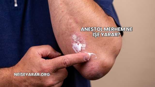 Anestol Merhem Ne İşe Yarar?