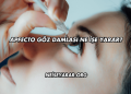 Apfecto Göz Damlası Ne İşe Yarar?