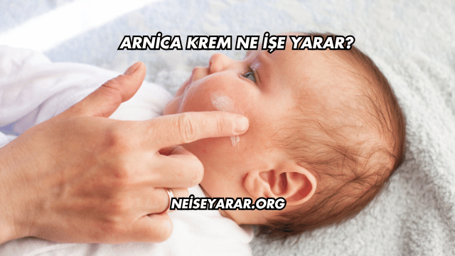 Arnica Krem Ne İşe Yarar?
