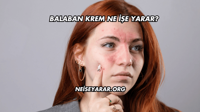 Balaban Krem Ne İşe Yarar?