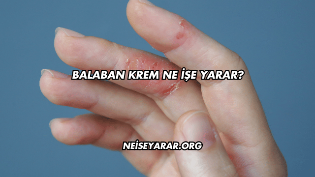 Balaban Krem Ne İşe Yarar?