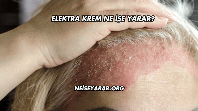 Elektra Krem Ne İşe Yarar?