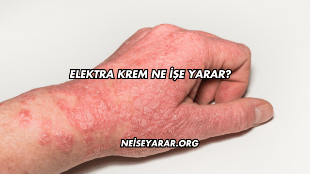 Elektra Krem Ne İşe Yarar?
