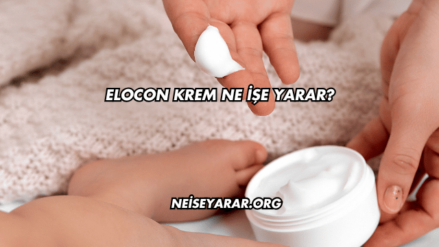 Elocon Krem Ne İşe Yarar?