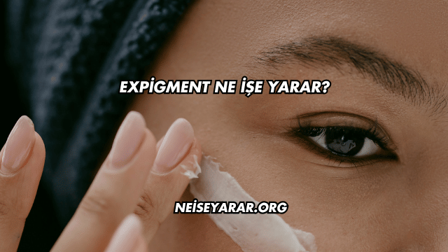 Expigment Ne İşe Yarar?