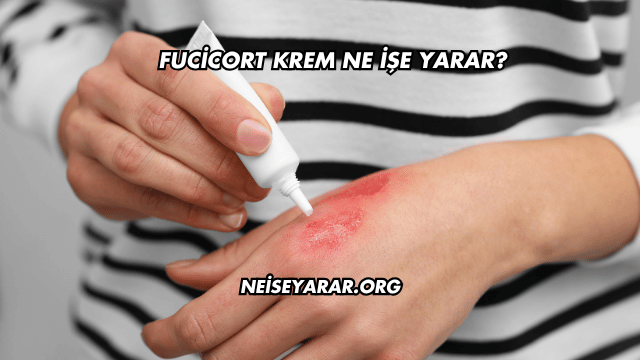 Fucicort Krem Ne İşe Yarar?