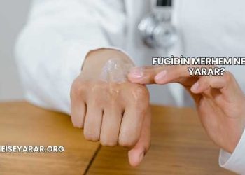 Fucidin Merhem Ne İşe Yarar?