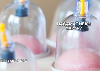 Hacamat Ne İşe Yarar?