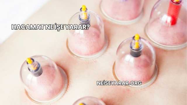 Hacamat Ne İşe Yarar?