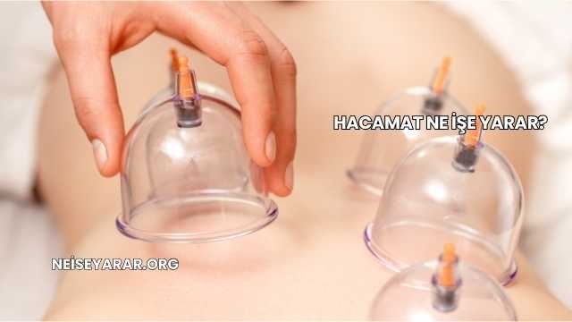 Hacamat Ne İşe Yarar?