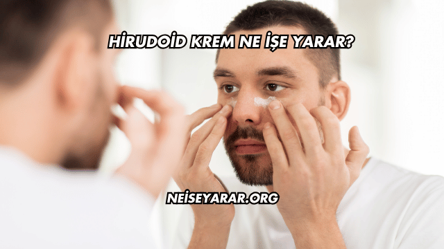 Hirudoid Krem Ne İşe Yarar?
