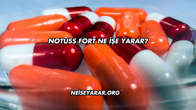 Notuss Fort Ne İşe Yarar?