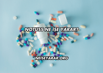 Notuss Ne İşe Yarar?
