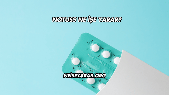 Notuss Ne İşe Yarar?