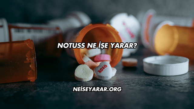 Notuss Ne İşe Yarar?
