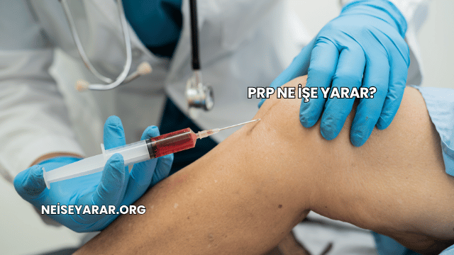 PRP Ne İşe Yarar?