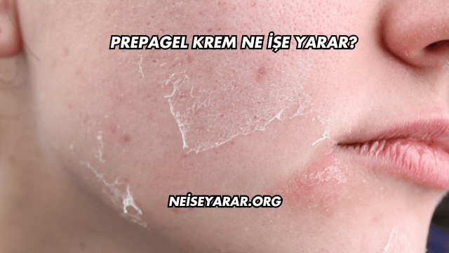 Prepagel Krem Ne İşe Yarar?