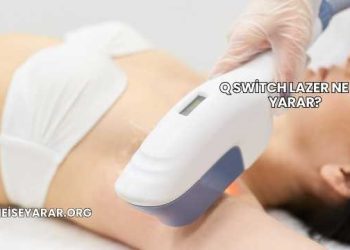 Q Switch Lazer Ne İşe Yarar?
