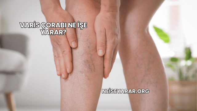 Varis Çorabı Ne İşe Yarar?